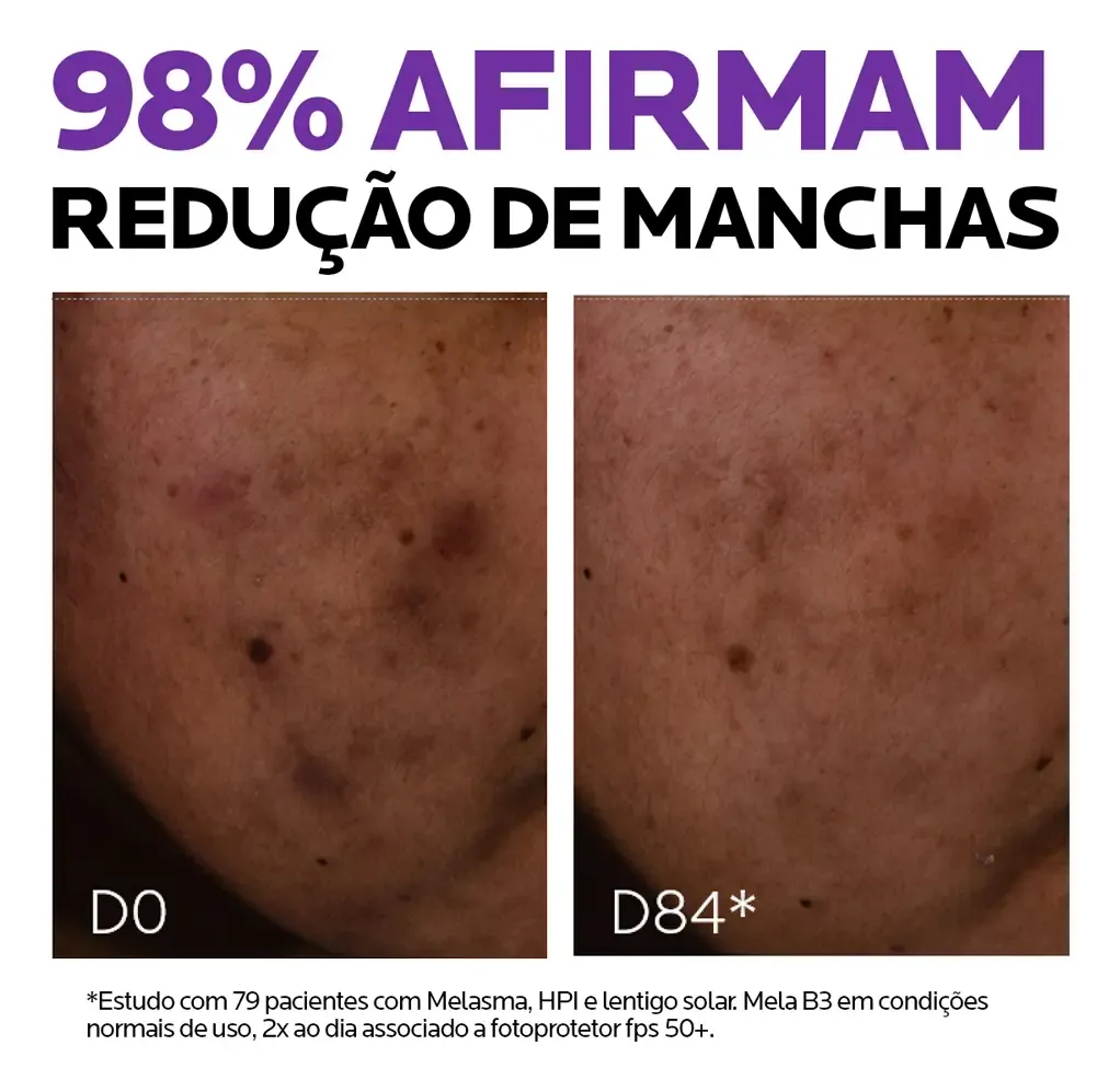 Exemplos reais da unificação do tom de pele com Mela B3.
